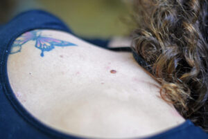 Municipio y LALCEC impulsan